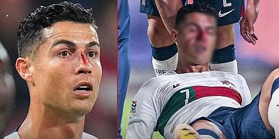 Kaleciyle çarpışıp kanlar içinde yere düşmüştü: İşte Ronaldo'nun son hali